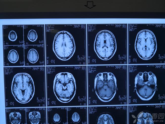 2025年天天彩资料大全和送小脑萎缩儿子高考与小脑萎缩能上学吗